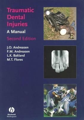 Traumatic Dental Injuries: A Manual