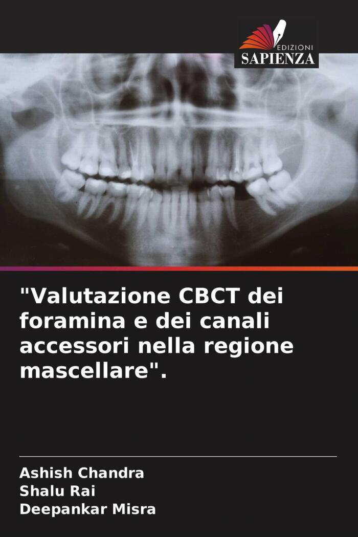 Valutazione CBCT Dei Foramina E Dei Canali Accessori Nella Regione Mascellare