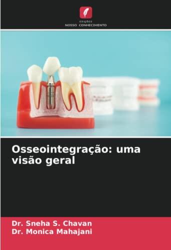 Osseointegração: uma visão geral