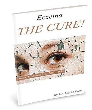 Eczema: The Cure