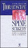 Thoracoscopic Spine Surgery, book + video set