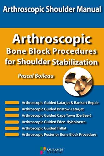 Arthrostopic Shoulder Manual: Arthrostopic Bone Block Procedures for Shoulder Stabilization