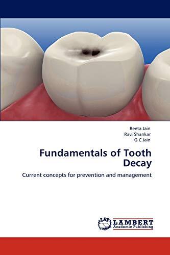 Fundamentals of Tooth Decay: Current Concepts for Prevention and Management