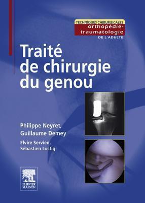 Trait de Chirurgie Du Genou Trait de Chirurgie Du Genou Trait de Chirurgie Du Genou Trait de Chirurgie Du Genou Trait de Chiru