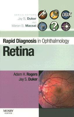 Rapid Diagnosis in Ophthalmology Series: Retina