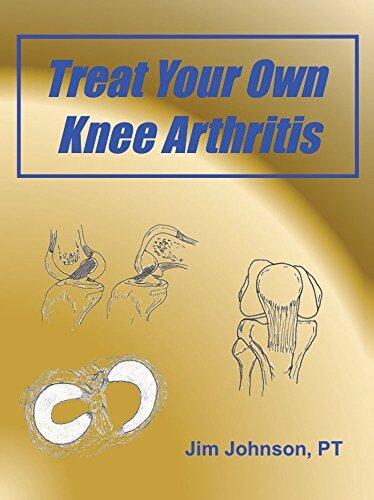 Treat Your Own Knee Arthritis