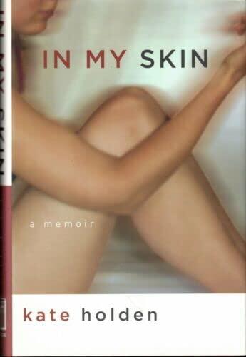 Rare In My Skin: A Memoir - NY: Arcade Publishing, 2006 [Hardcover] Holden, Kate