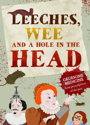 Leeches, Pee, and a Hole in the Head: Gruesome medicine and terrible treatments from the past