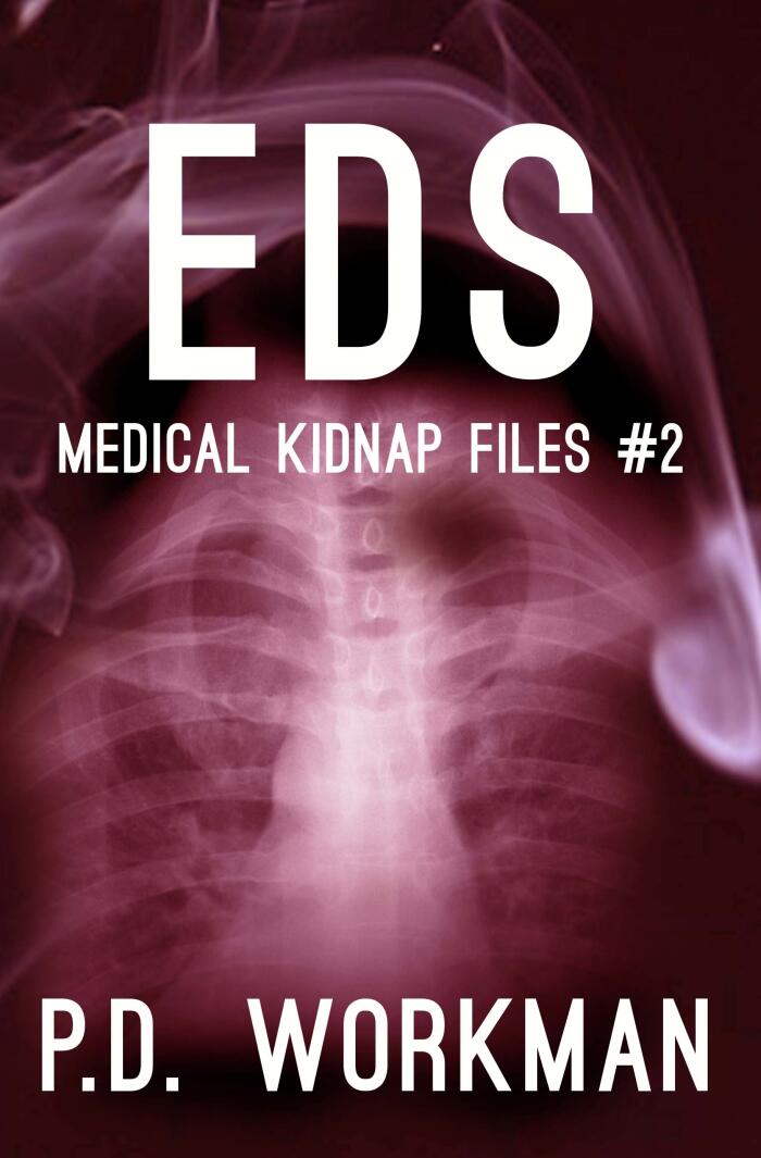EDS