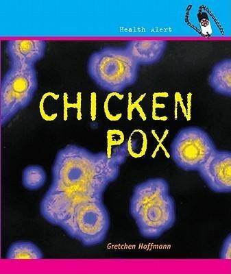 By Hoffmann, Gretchen Chickenpox (Health Alert) Hardcover - September 2008