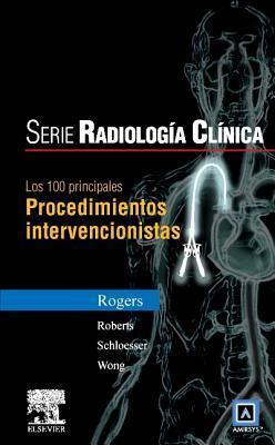 Los 100 Principales Procedimientos Intervencionistas (Serie Pocket de Radiologia)
