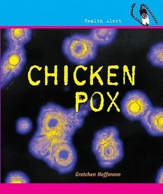 Chicken Pox