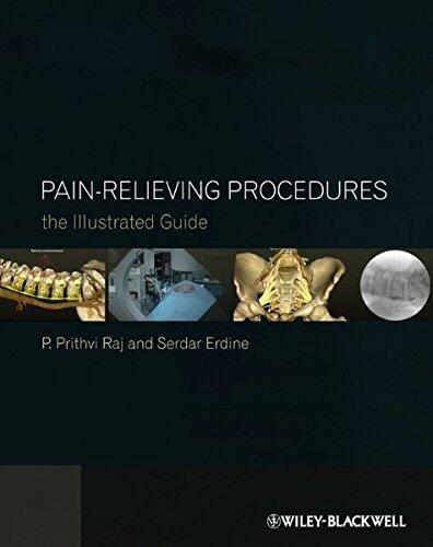 Pain-Relieving Procedures: The Illustrated Guide (1st Edition)