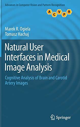 Natural User Interfaces in Medical Image Analysis: Cognitive Analysis of Brain and Carotid Artery Images