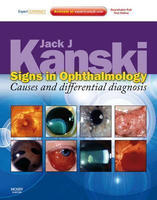 Signs in Ophthalmology: Causes and Differential Diagnosis E-Book: Expert Consult - Online and Print