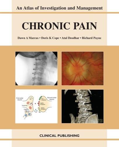 Chronic Pain: An Atlas of Investigation and Management