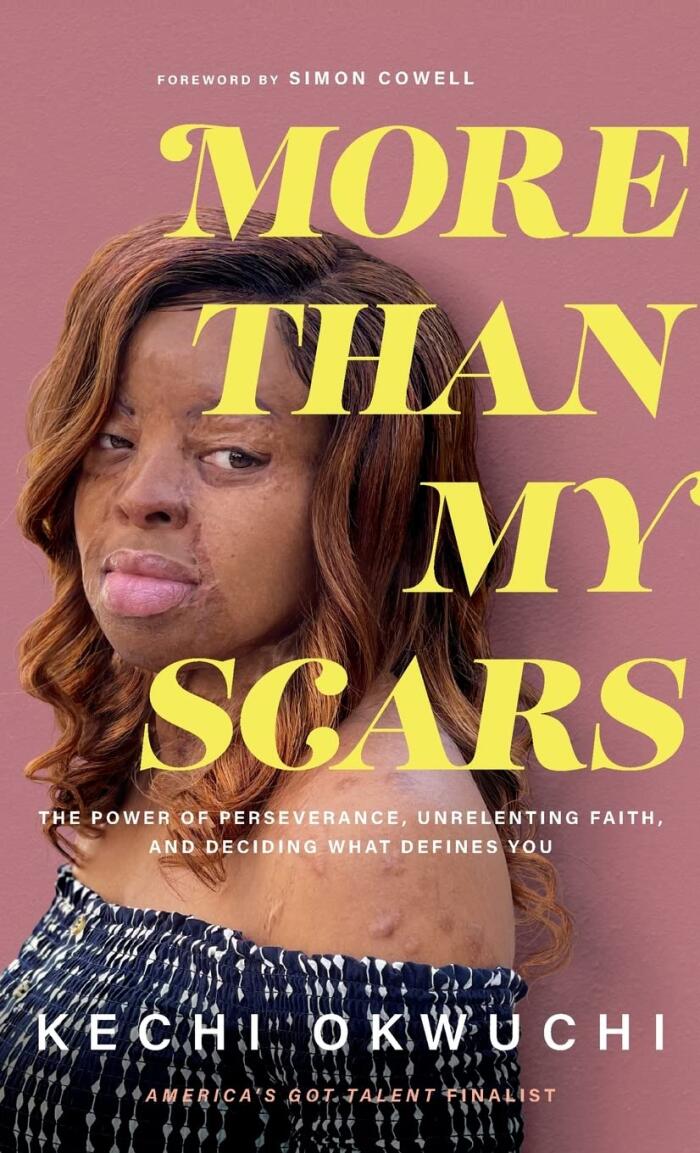More Than My Scars: The Power of Perseverance, Unrelenting Faith, and Deciding What Defines You