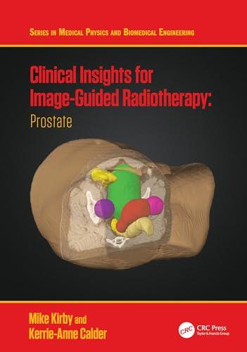 Clinical Insights for Image-Guided Radiotherapy: Prostate