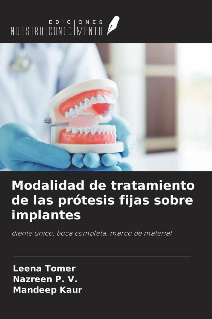 Modalidad de Tratamiento de las Prótesis Fijas sobre Implantes: Diente Único, Boca Completa, Marco de Material