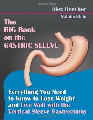 By Alex Brecher - The Big Book on the Gastric Sleeve: Everything You Need to Know to Lose Weight and Live Well with the Vertical Sleeve Gastrectomy