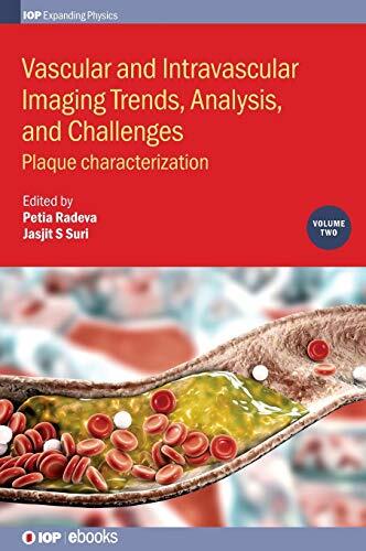 Vascular and Intravascular Imaging Trends, Analysis, and Challenges: Plaque Characterization
