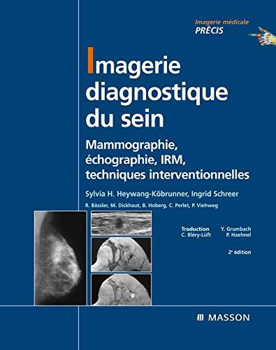 Imagerie Diagnostique du Sein: Mammographie, Échographie, IRM, Techniques Interventionnelles