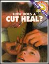 How Does a Cut Heal?