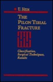 The Tibial Pilon Fracture: Classification, Surgical Techniques, Results
