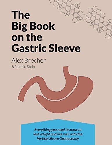 The Big Book on the Gastric Sleeve: Everything You Need to Know to Lose Weight and Live Well