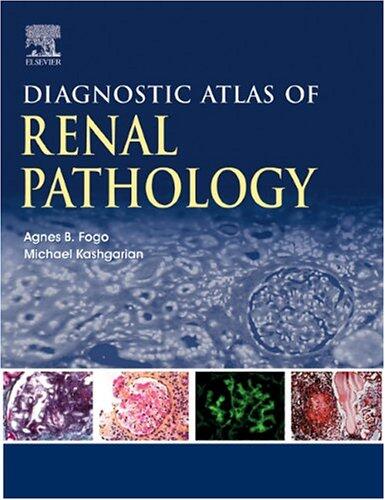 Diagnostic Atlas of Renal Pathology