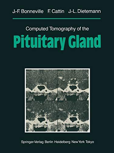 Computed Tomography of the Pituitary Gland: With a Chapter on Magnetic Resonance Imaging of the Sellar and Juxtasellar Region