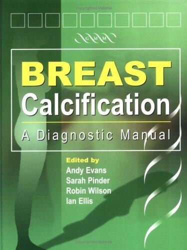 Breast Calcification: A Diagnostic Manual